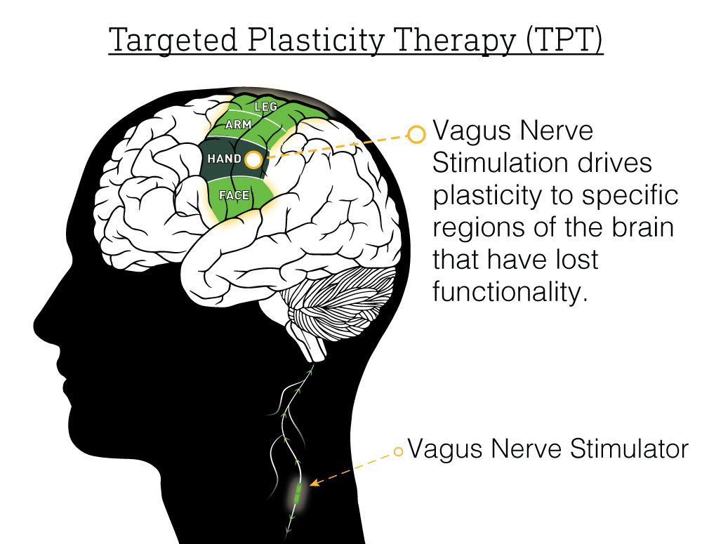 Targeted Plasticity Therapy